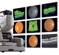 Ophthalmic OCT Devices
